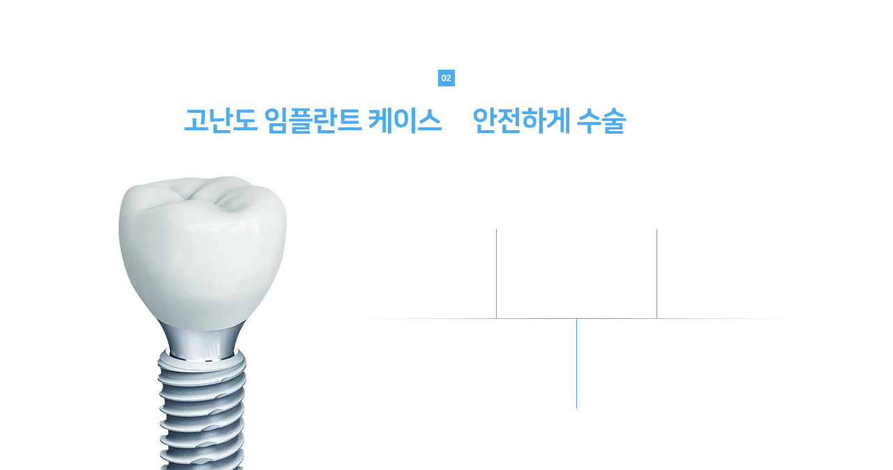 고난도 임플란트 케이스도 안전하게 수술합니다 - 치료 전후 엑스레이 사례